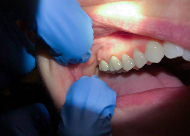Best Orthodontic Emergency Dentist in Oakland Park, FL